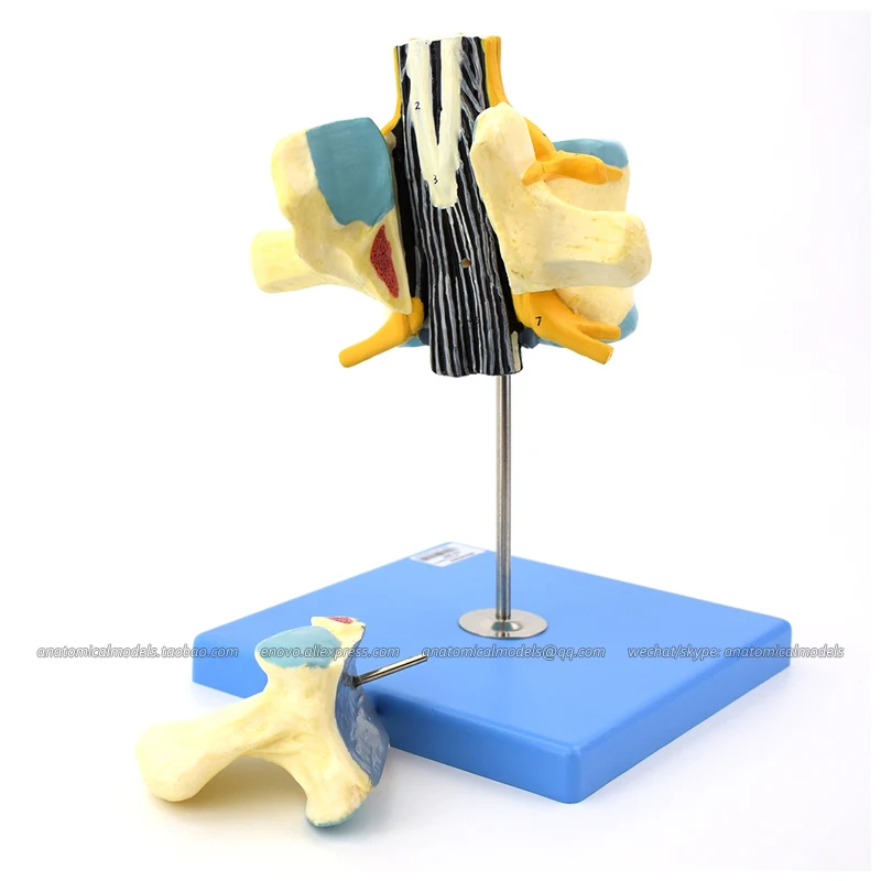 CMAM/12395-1 Lumbar with Spinal Cord, Cauda Equina Enlarged Model, Medical Backbone Anatomical Human Model
CMAM/12395-1 Lumbar with Spinal Cord, Cauda Equina Enlarged Model, Medical Backbone Anatomical Human Model