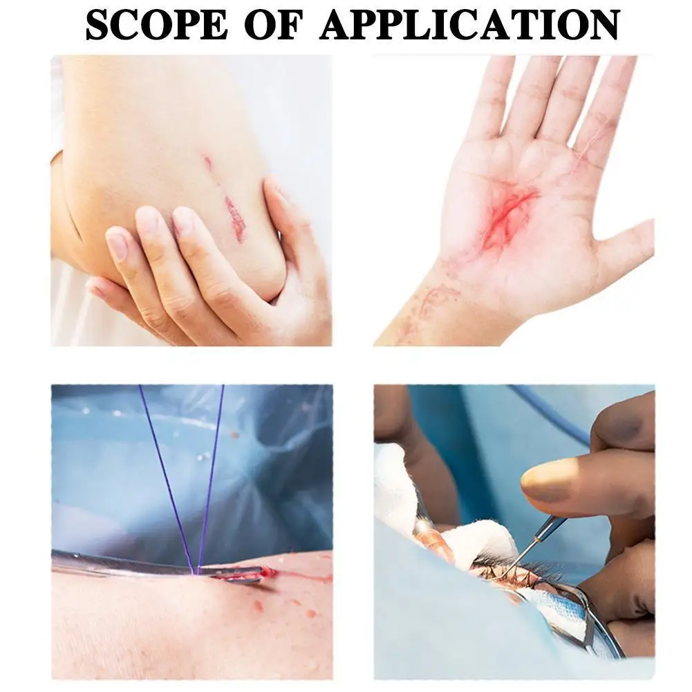 4/10pcs Zipper Band-aid Painless Wound Closure Device Dressing Wound Needles Suture Zip Suture-free Aid Band Without Patch R5W3 
4/10pcs Zipper Band-aid Painless Wound Closure Device Dressing Wound Needles Suture Zip Suture-free Aid Band Without Patch R5W3