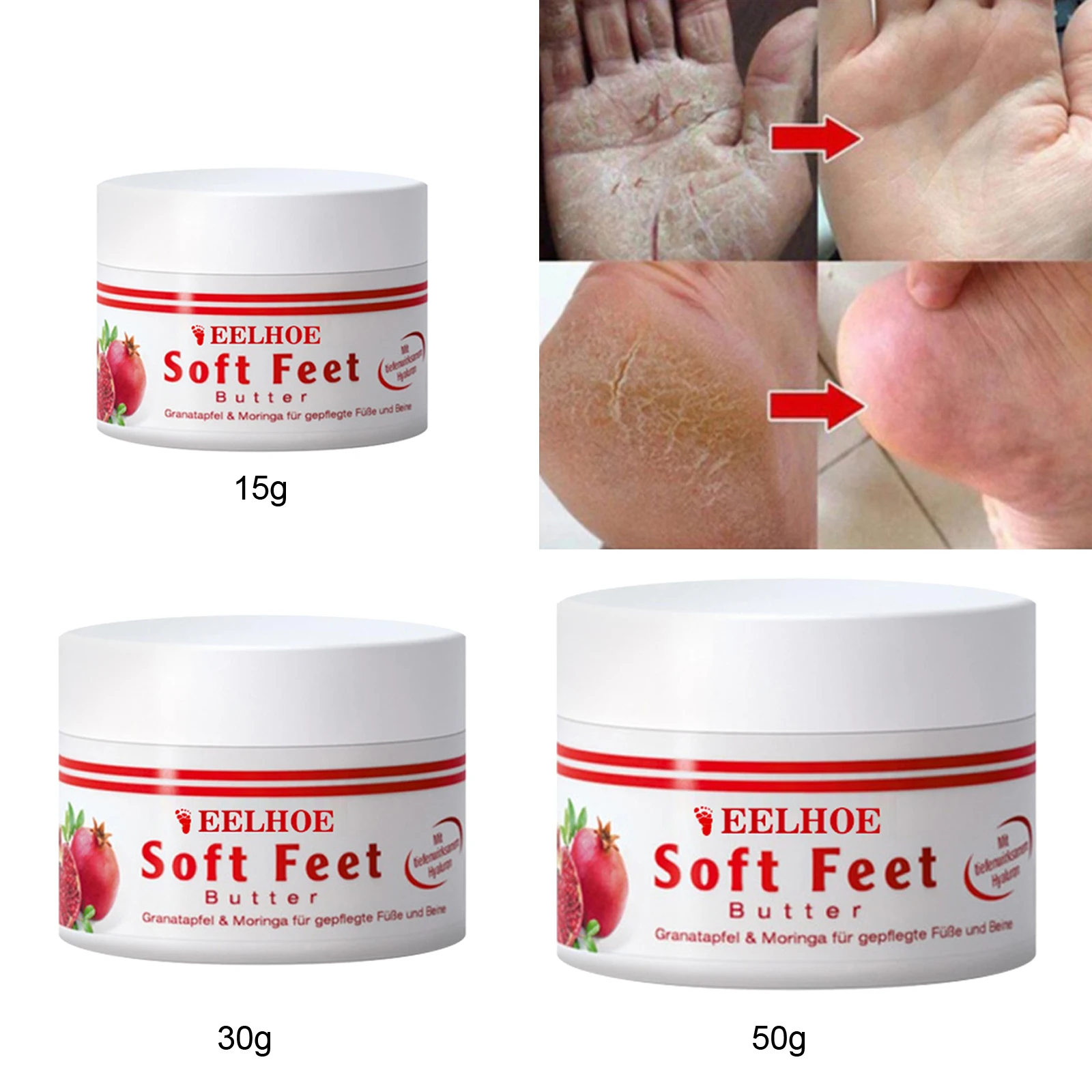 Repair Body Repairing Treatment Cream for Hand Combat Dryness Anti-Drying Crack Foot Cream 
Repair Body Repairing Treatment Cream for Hand Combat Dryness Anti-Drying Crack Foot Cream