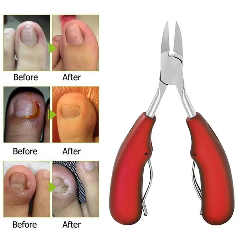 New Professional Toe Nail Clippers Cutter Pliers Heavy Thick Nails Tool Cut Nail Stainless Nose Trimmer Heavy Duty Nail Clippers
New Professional Toe Nail Clippers Cutter Pliers Heavy Thick Nails Tool Cut Nail Stainless Nose Trimmer Heavy Duty Nail Clippers