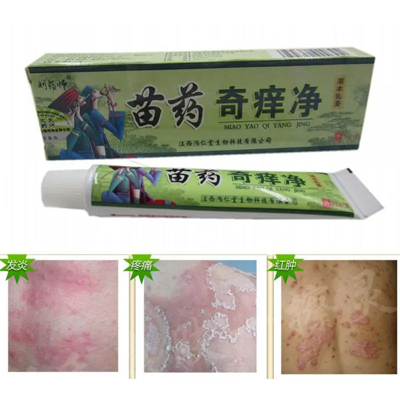 China Hmong Balm Inhibition Fungal infections Foot And Ringworm Actinic Dermatitis Psoriasis Balanitis Hemorrhoids Acne Vulgaris
China Hmong Balm Inhibition Fungal infections Foot And Ringworm Actinic Dermatitis Psoriasis Balanitis Hemorrhoids Acne Vulgaris
