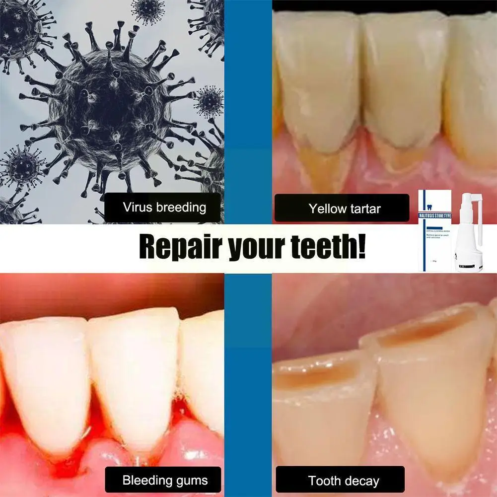 30g Bad Breath Dental Calculus Spray Effectively Clean Mouth Breath Remove The And Teeth Whiten Spray Bad Breath R0p9
30g Bad Breath Dental Calculus Spray Effectively Clean Mouth Breath Remove The And Teeth Whiten Spray Bad Breath R0p9