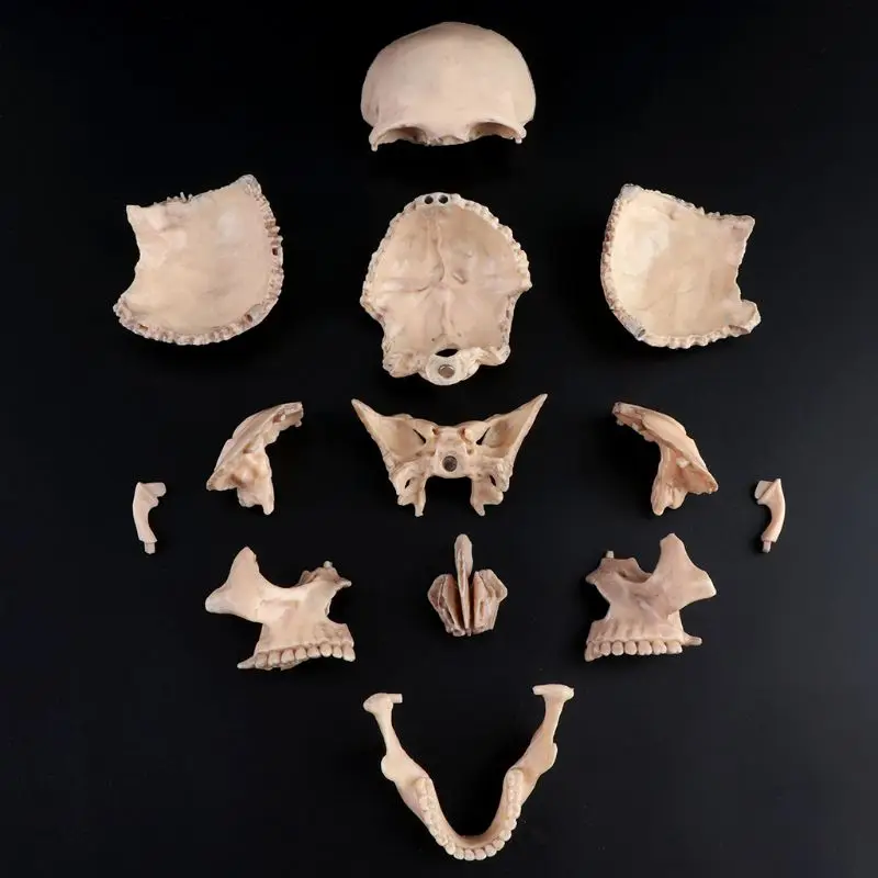 15pcs/set 4D Disassembled Color Skull Anatomical Model Detachable Medical Teaching Tool
15pcs/set 4D Disassembled Color Skull Anatomical Model Detachable Medical Teaching Tool