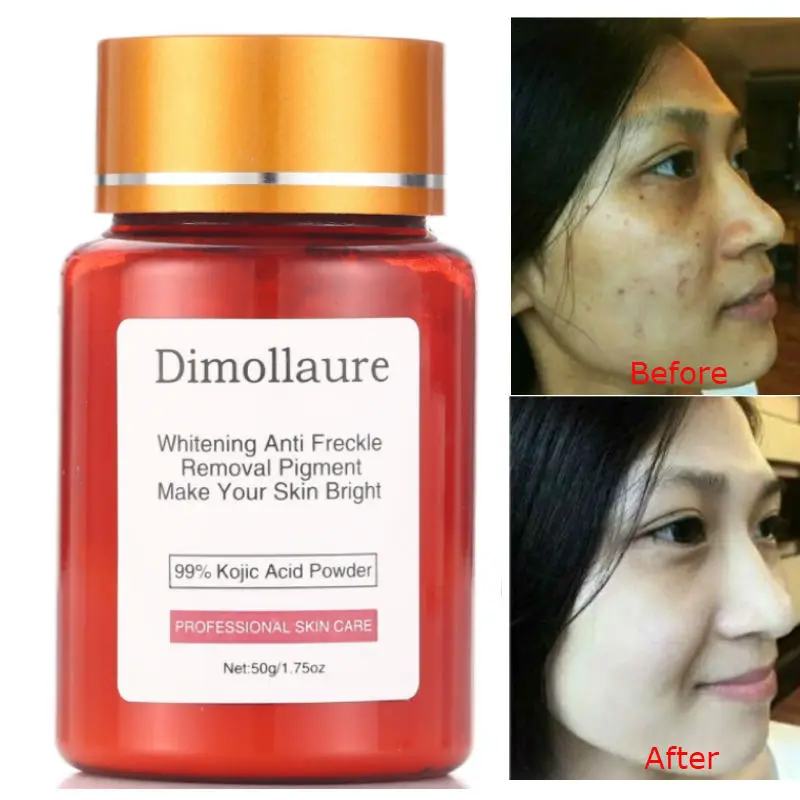 Dimollaure 50g Pure 99% Kojic Acid Powder Face Care Whitening Cream Remove Freckle Melasma Acne Spots Pigment Skin Care
Dimollaure 50g Pure 99% Kojic Acid Powder Face Care Whitening Cream Remove Freckle Melasma Acne Spots Pigment Skin Care
