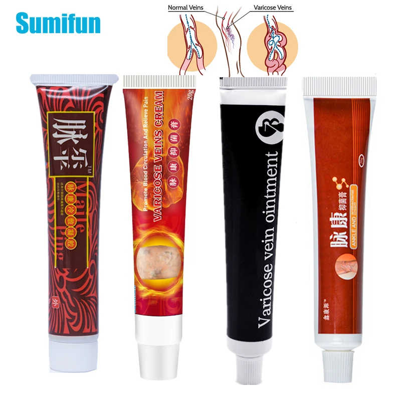 1pcs Varicose Veins Cream 4 Types Treatment Vasculitis Phlebitis Spider Ointment Varicosity Angiitis Removal Medical Plaster
1pcs Varicose Veins Cream 4 Types Treatment Vasculitis Phlebitis Spider Ointment Varicosity Angiitis Removal Medical Plaster