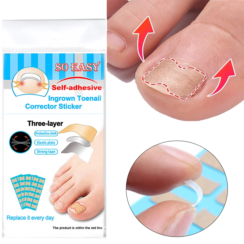 36/48/60pcs Nail Correction Sticker Toenail Ingrown Paronychia Pedicure Tool Toe Inlay Corrector Elastic professional Nail Patch
36/48/60pcs Nail Correction Sticker Toenail Ingrown Paronychia Pedicure Tool Toe Inlay Corrector Elastic professional Nail Patch
