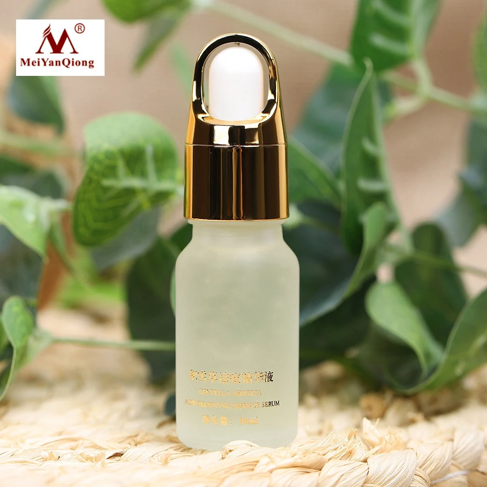 10ml Acne Pimple Removal Essence Shrinking Pores Serum Natural Ingredients Facial Serum Essence
10ml Acne Pimple Removal Essence Shrinking Pores Serum Natural Ingredients Facial Serum Essence