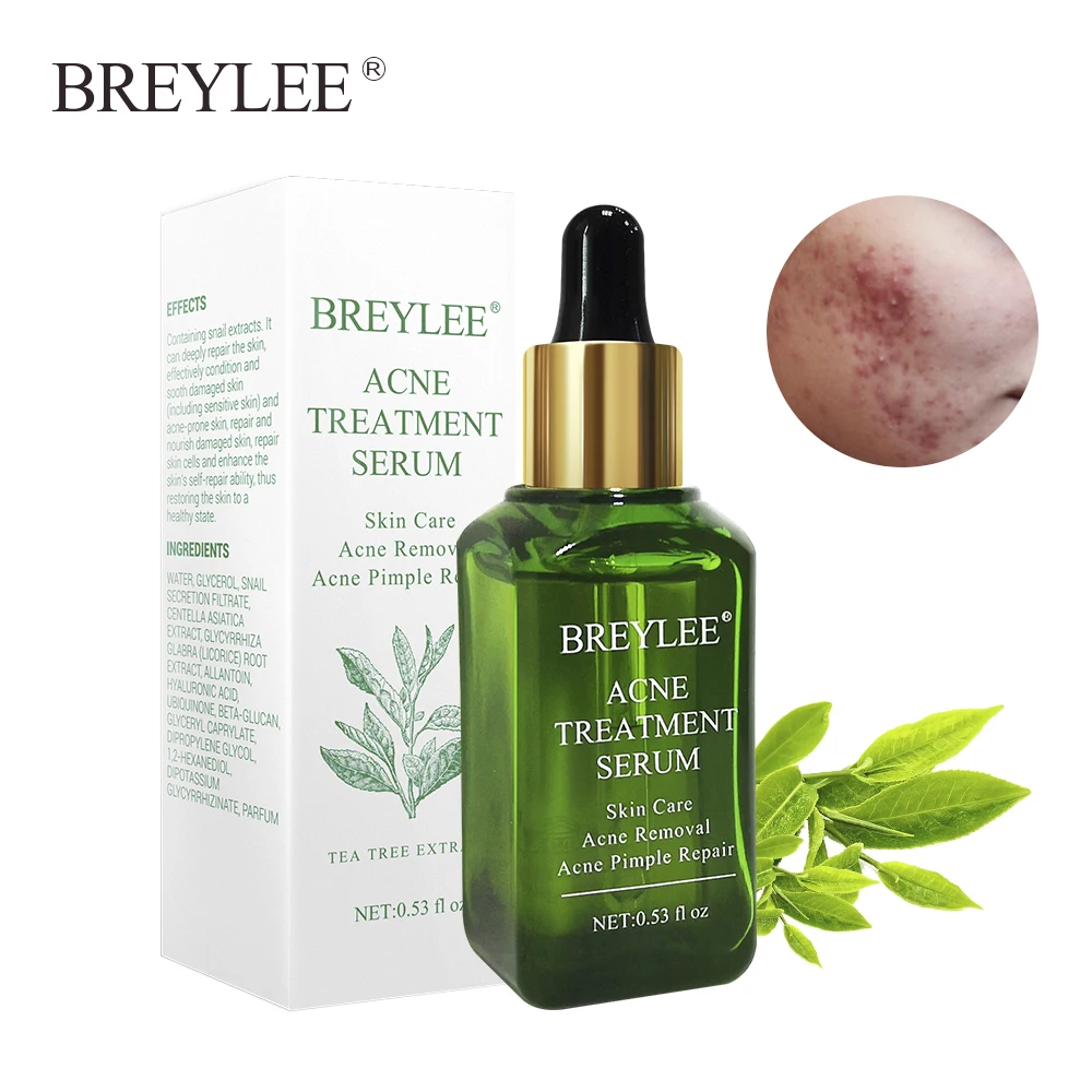 5 PCS BREYLEE Acne Treatment Serum Facial Essence Anti Acne Scar Removal Serum Face Skin Care Whitening Pimple Remover For Acne
5 PCS BREYLEE Acne Treatment Serum Facial Essence Anti Acne Scar Removal Serum Face Skin Care Whitening Pimple Remover For Acne