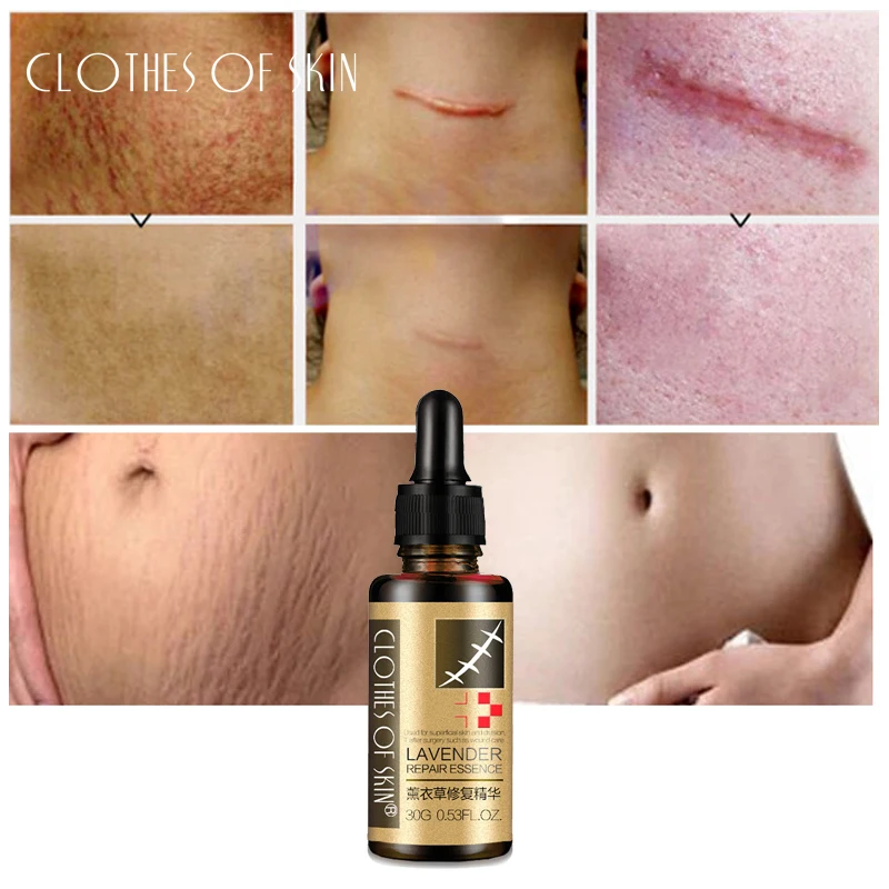 Фото JIFUYI Гиалуроновая кислота Сыворотка для лица крем от прыщей Mark Essence лечение