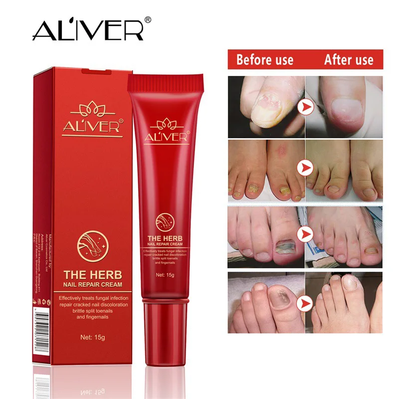 Hot sale Nail Repair Cream Nourishing Herb Fingernail Care Treatment Striking Ointment
Hot sale Nail Repair Cream Nourishing Herb Fingernail Care Treatment Striking Ointment
