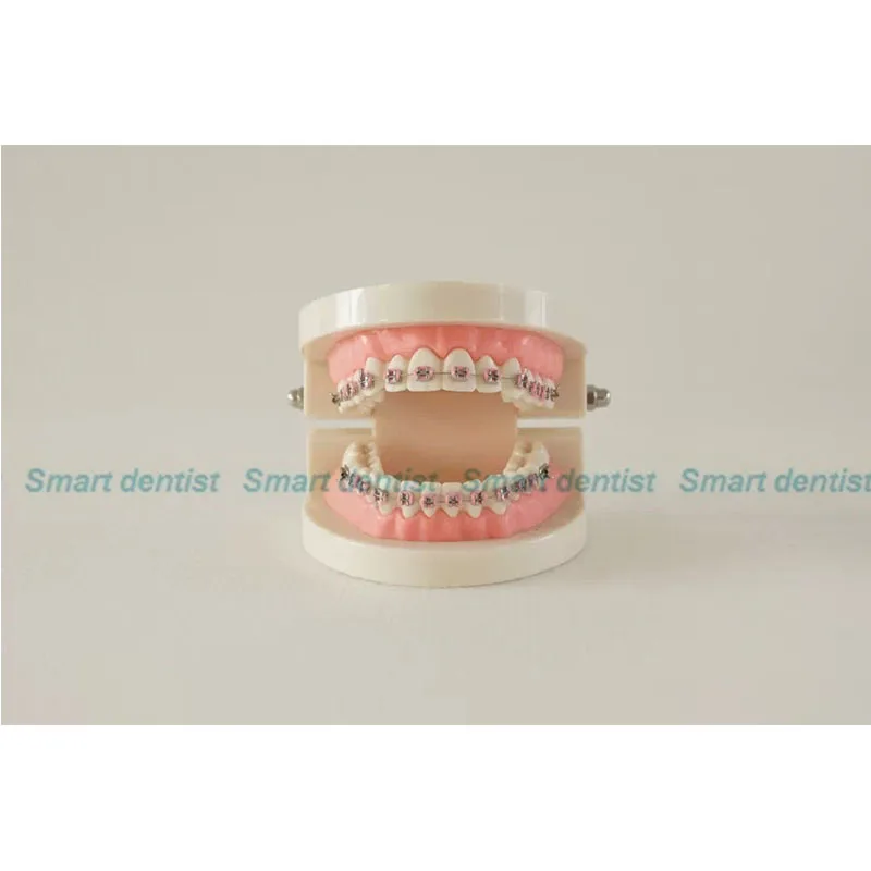 Correcting tooth dental tooth model Dental Orthodontic Tooth Model dentistry tool dentistry equipments
Correcting tooth dental tooth model Dental Orthodontic Tooth Model dentistry tool dentistry equipments