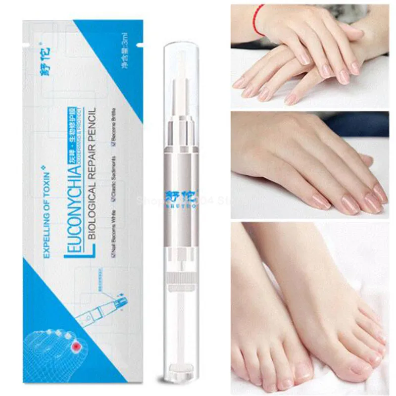 1PC 3ML Fungal Nail Treatment Pen Onychomycosis Paronychia Anti Fungal Nail Infection Chinese Herbal Care Medicinal Liquid
1PC 3ML Fungal Nail Treatment Pen Onychomycosis Paronychia Anti Fungal Nail Infection Chinese Herbal Care Medicinal Liquid