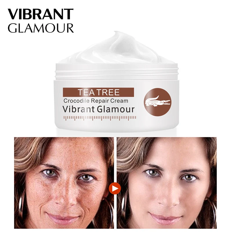 Crocodile Repair Face Cream 30g Acne Scar Removal Whitening Cream Anti-spots Acne Stretch Marks Skin Wrinkles Lines Repair Cream
Crocodile Repair Face Cream 30g Acne Scar Removal Whitening Cream Anti-spots Acne Stretch Marks Skin Wrinkles Lines Repair Cream