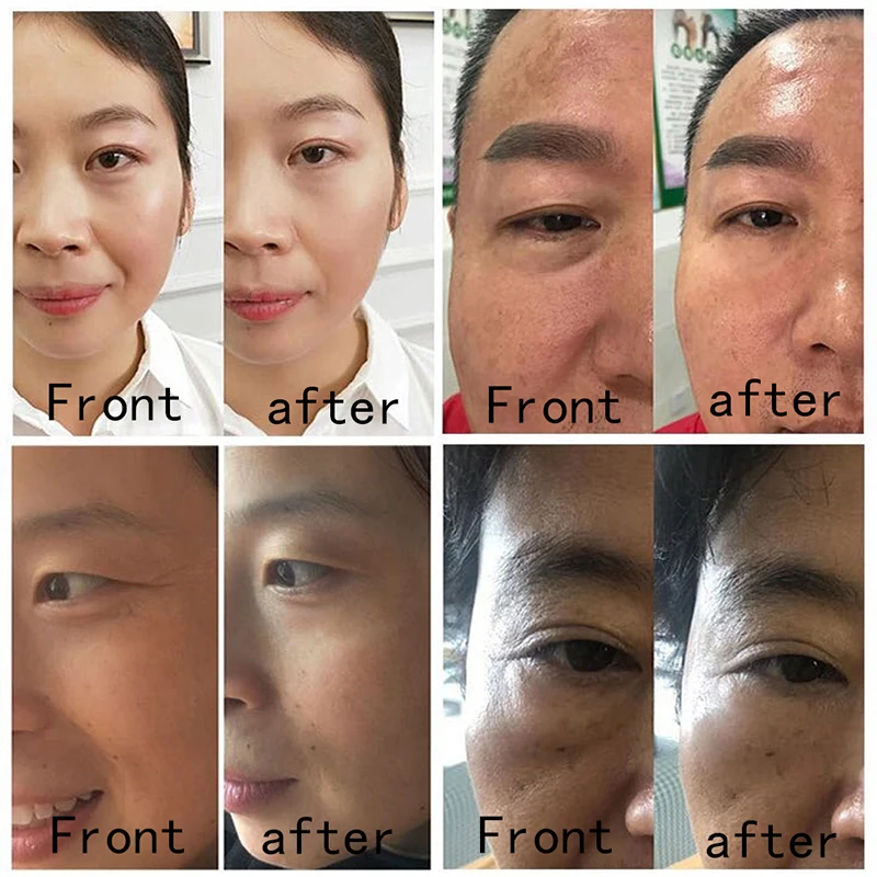 Hot Liquild Eye Cream Anti-Wrinkle Anti-aging Remover Dark Circles Eye Care Against Puffiness And Bags
Hot Liquild Eye Cream Anti-Wrinkle Anti-aging Remover Dark Circles Eye Care Against Puffiness And Bags