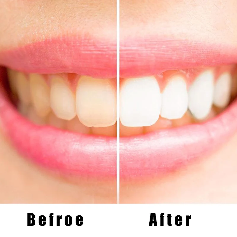 Teeth Whitening Liquid Oral Hygiene Cleaning Teeth Care Cleaning Liquid NShopping
Teeth Whitening Liquid Oral Hygiene Cleaning Teeth Care Cleaning Liquid NShopping
