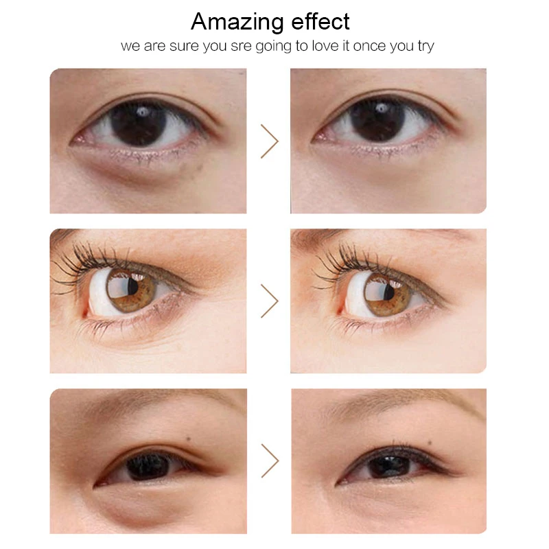 60pcs/120pcs Collagen Eye Mask Hydrogel Eye Patches Under the Eyes Care Repair Dark Circles Anti Aging Sheet Face Mask Eye Pads
60pcs/120pcs Collagen Eye Mask Hydrogel Eye Patches Under the Eyes Care Repair Dark Circles Anti Aging Sheet Face Mask Eye Pads