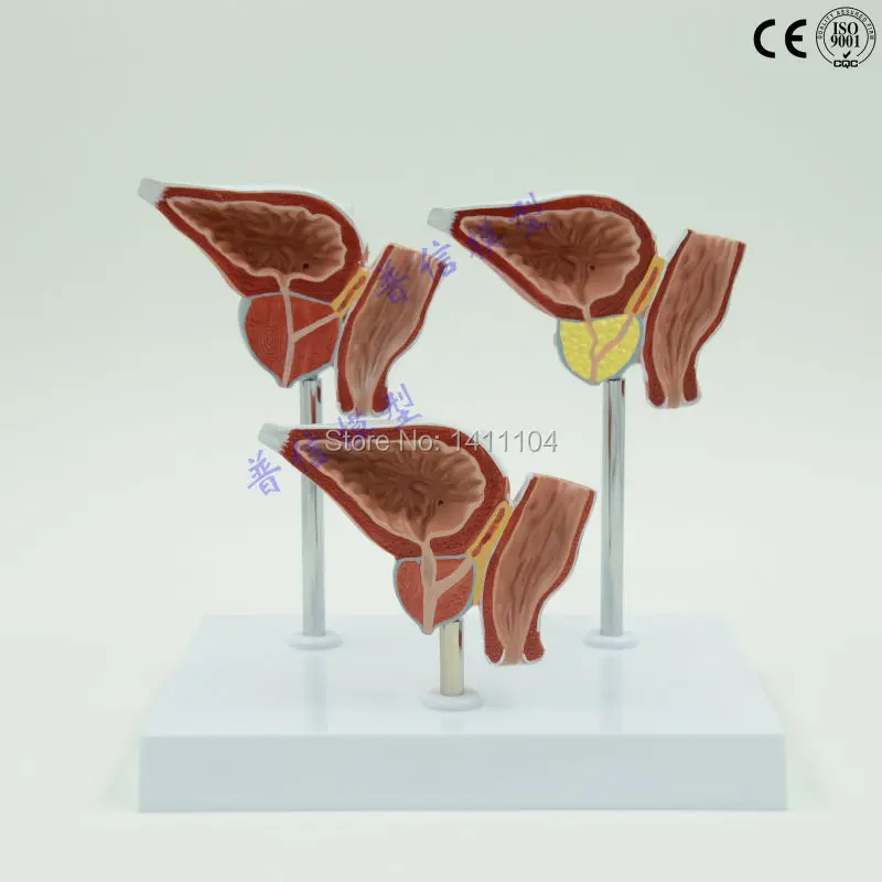 Free shipping&Prostatic hyperplasia, carcinogenesis, male division model, organ dissection model, medical, prostate model.
Free shipping&Prostatic hyperplasia, carcinogenesis, male division model, organ dissection model, medical, prostate model.