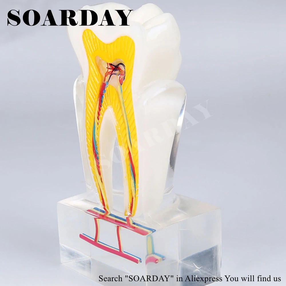 SOARDAY Six times the tooth nerve anatomy teaching model Pathological dental tooth teeth anatomy model odontologia
SOARDAY Six times the tooth nerve anatomy teaching model Pathological dental tooth teeth anatomy model odontologia