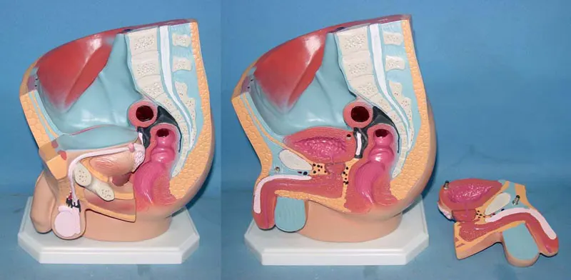 Men intraperitoneal Planning model Genital anatomy model Medical Teaching Aids free shipping
Men intraperitoneal Planning model Genital anatomy model Medical Teaching Aids free shipping
