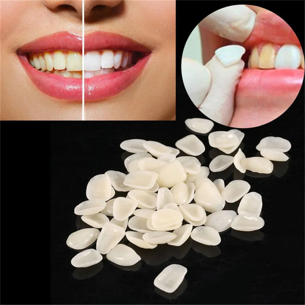 Dental Teeth care Veneers Ultra Thin Whitening Resin Anterior Upper Temporary Crown Porcelain Dental Material Oral Care
Dental Teeth care Veneers Ultra Thin Whitening Resin Anterior Upper Temporary Crown Porcelain Dental Material Oral Care