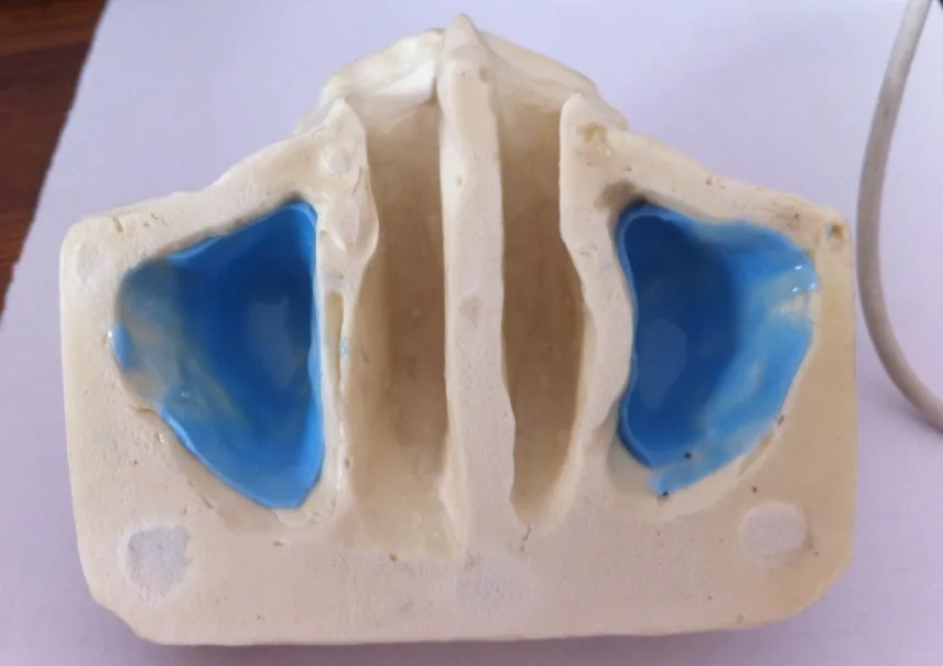 Free Shipping Sinus practice model for education dental tooth teeth dentist anatomical anatomy model odontologia
Free Shipping Sinus practice model for education dental tooth teeth dentist anatomical anatomy model odontologia
