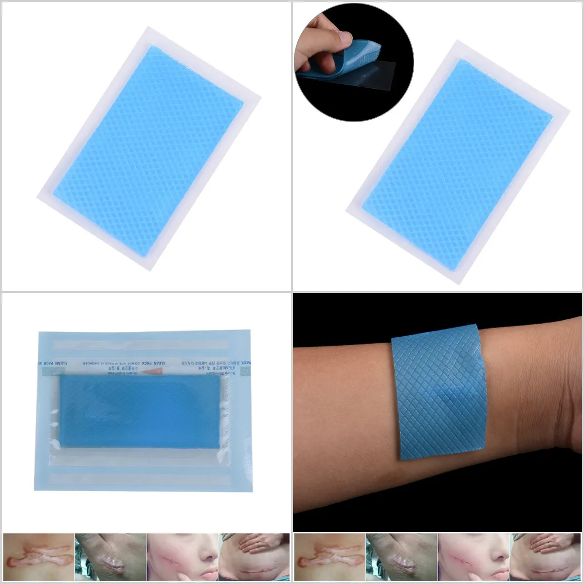 

Силиконовая гелевая пластина раны Знаки шрам от патч для удаления кесарево сечение гипертрофических келоидные шрамы кожи терапии 3,5*7 см