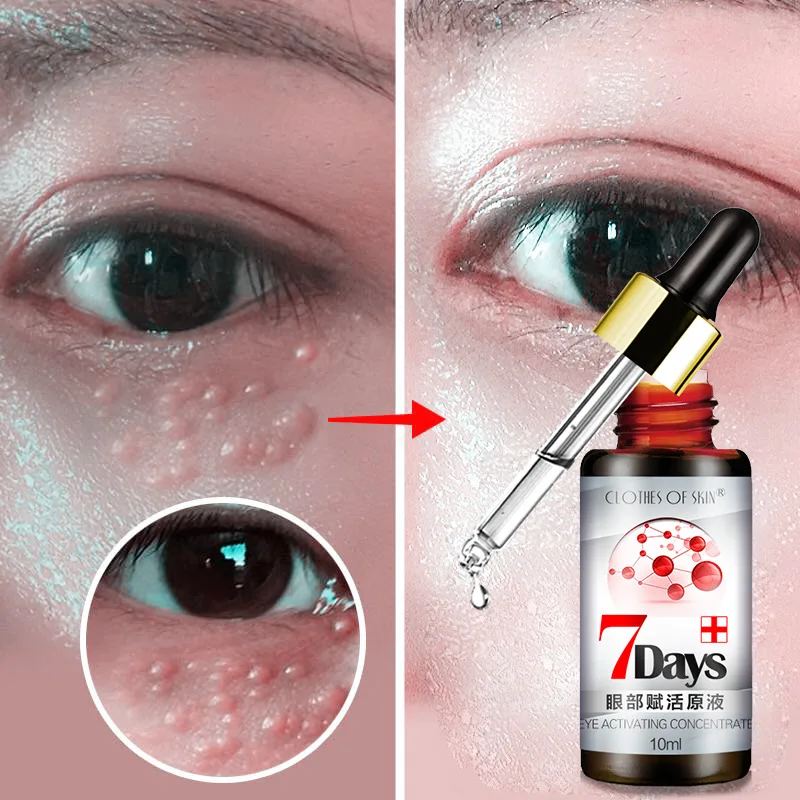 Newest Anti-Puffiness Remove wrinkles Eyes Serum Remove Fat Granule Dark Circle Anti-Aging Moisturizing Eye Cream
Newest Anti-Puffiness Remove wrinkles Eyes Serum Remove Fat Granule Dark Circle Anti-Aging Moisturizing Eye Cream