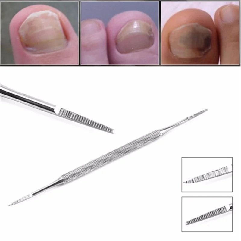 Hot 2Pcs Double Ended Pedicure Blacks File Satin Edge Ingrown Toe Nail Lifter Onychomycosis Paronychia Nail Cleaning Instrument
Hot 2Pcs Double Ended Pedicure Blacks File Satin Edge Ingrown Toe Nail Lifter Onychomycosis Paronychia Nail Cleaning Instrument