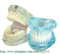 Free Shipping Natural size model (HH) dental tooth teeth dentist dentistry anatomical anatomy model odontologia
Free Shipping Natural size model (HH) dental tooth teeth dentist dentistry anatomical anatomy model odontologia