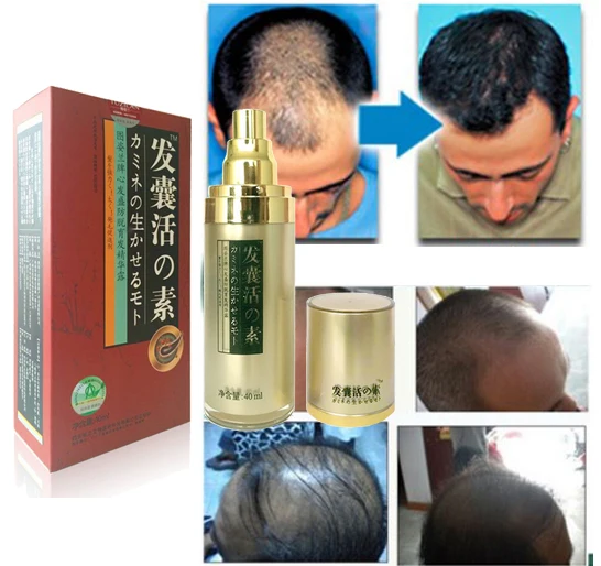 Оригинальный Sunburst Andrea быстрого роста волос Pilatory сущность человеческие волосы