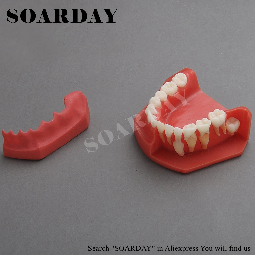 SOARDAY Dentist Alternating Development Dental Model Primary Teeth to Permanent Teeth Soft Gums Removable for Child 9-12 years
SOARDAY Dentist Alternating Development Dental Model Primary Teeth to Permanent Teeth Soft Gums Removable for Child 9-12 years