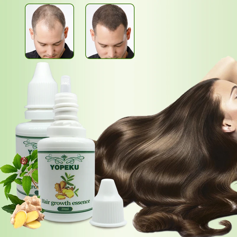 Powerful Fast Hair Growth Essential Oil Products Natural Ginger Essence Treatment Preventing Hair Loss Hair Care Liquid 20ml
Powerful Fast Hair Growth Essential Oil Products Natural Ginger Essence Treatment Preventing Hair Loss Hair Care Liquid 20ml