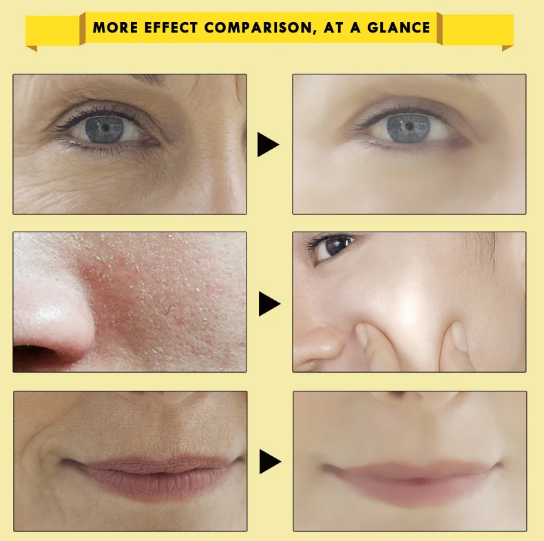 OEDO Shrink Pores Gold Hyaluronic Acid liquid Moisturizing Face Serum Whitening Plant Skin Care Anti Aging Anti Wrinkle Cream
OEDO Shrink Pores Gold Hyaluronic Acid liquid Moisturizing Face Serum Whitening Plant Skin Care Anti Aging Anti Wrinkle Cream
