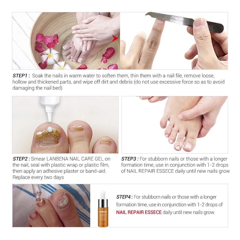 LANBENA Nail Care Gel Fungal Nail Treatment Remove Onychomycosis Nail Care Nourishing Effective Against Nail Hand and Foot Care
LANBENA Nail Care Gel Fungal Nail Treatment Remove Onychomycosis Nail Care Nourishing Effective Against Nail Hand and Foot Care