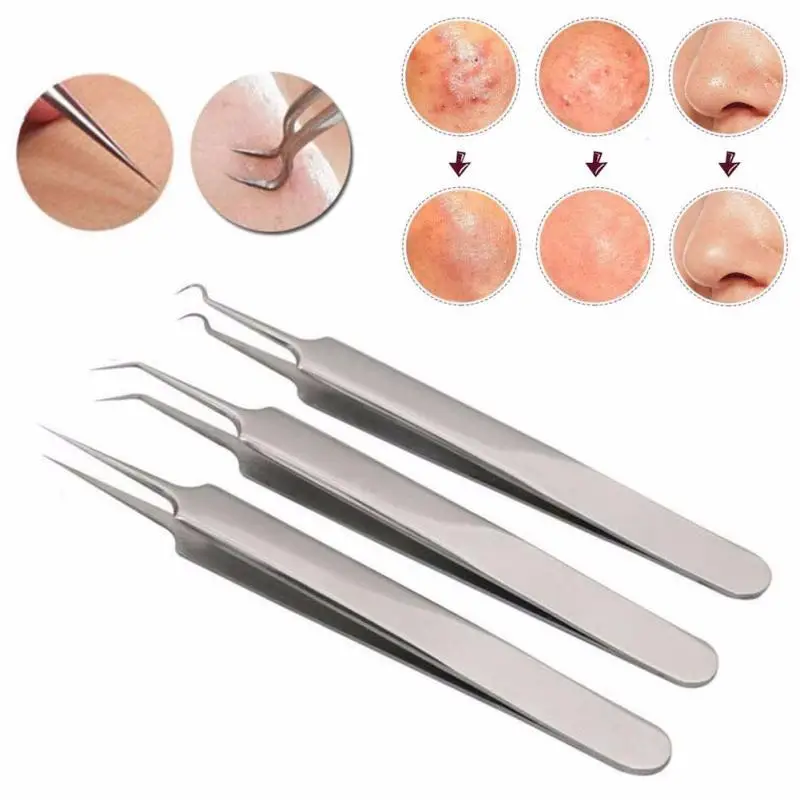 

Straight Bend Curved Blackhead Acne Clip Tweezer Pimple Comedone Remover Kit Face Comedone Acne Blemish Extractor Cleaner Tools