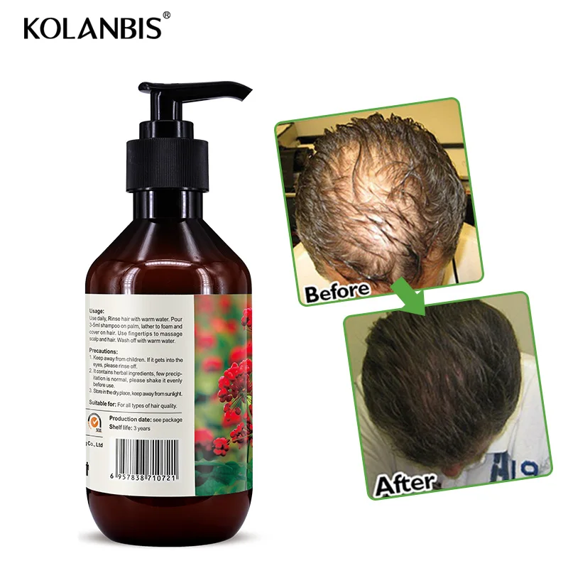 Anti Hair Loss Shampoo Thick Fast Hair Growth Hair Restore Treatment Organic Hair Regrowth Protein Product
Anti Hair Loss Shampoo Thick Fast Hair Growth Hair Restore Treatment Organic Hair Regrowth Protein Product