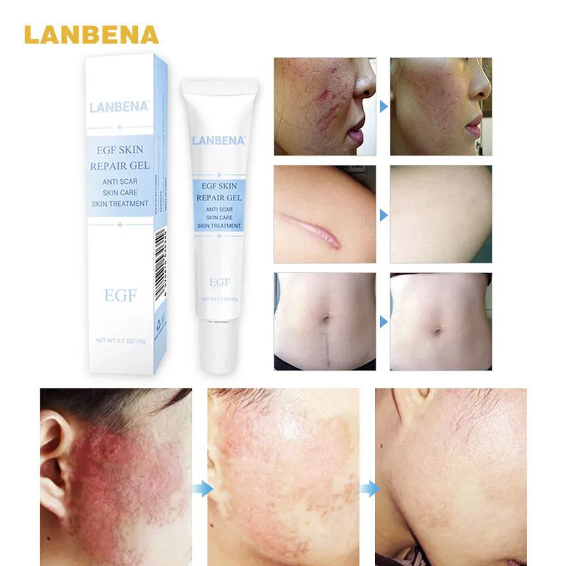 LANBENA EGF гель для восстановления кожи крем удаления шрамов увлажняющий уход за