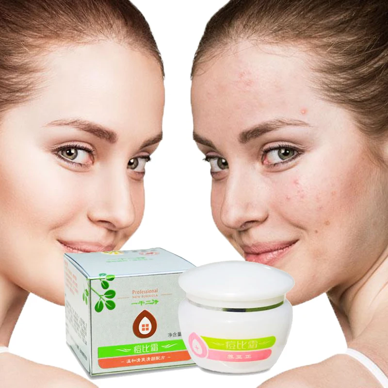 1pc yiganerjing 30g acne cream removing acne marks, acne marks, grease excess safety and effective no side effects
1pc yiganerjing 30g acne cream removing acne marks, acne marks, grease excess safety and effective no side effects