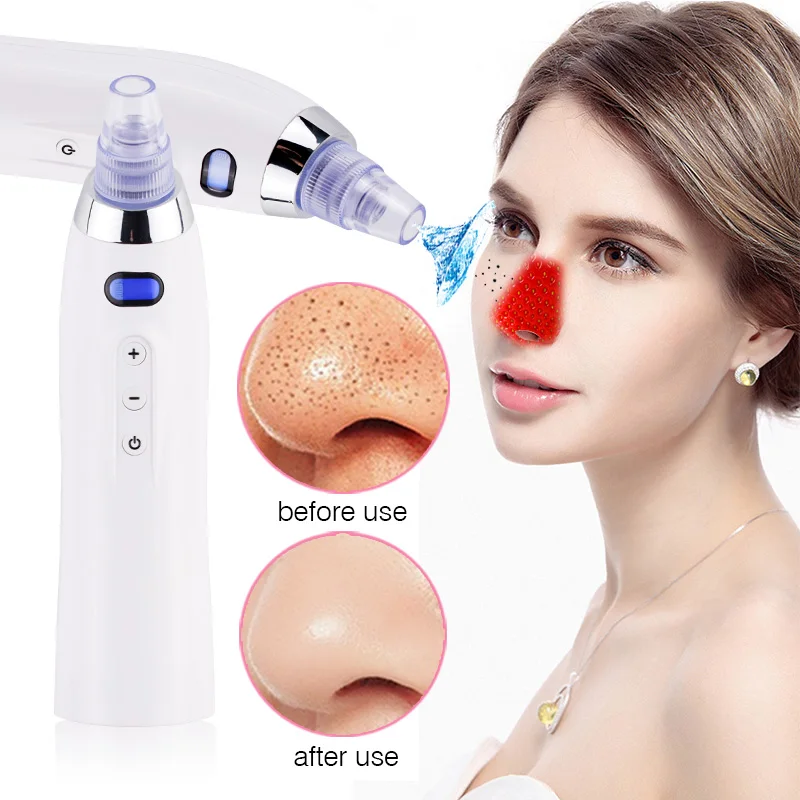 Vacuum Pore Black Spot Blackhead Facial Acne Clean Exfoliating Cleansing Tightening Skin Face Instrument Diamond Dermabrasion
Vacuum Pore Black Spot Blackhead Facial Acne Clean Exfoliating Cleansing Tightening Skin Face Instrument Diamond Dermabrasion