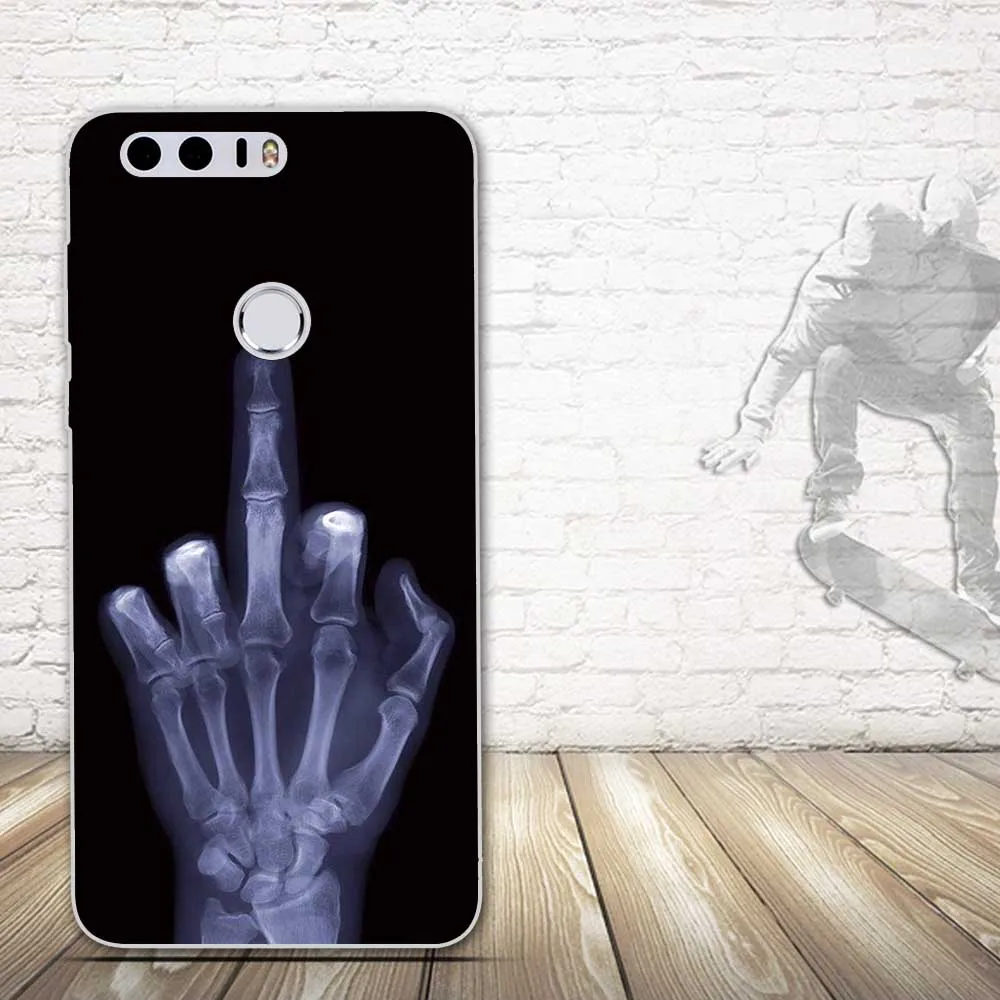 Soft TPU Case for Huawei Honor 8 FRD-L19 L14 Case Silicone Back Phone Cover For Huawei Honor8 Cover Print Painted Shells Fundas
Soft TPU Case for Huawei Honor 8 FRD-L19 L14 Case Silicone Back Phone Cover For Huawei Honor8 Cover Print Painted Shells Fundas