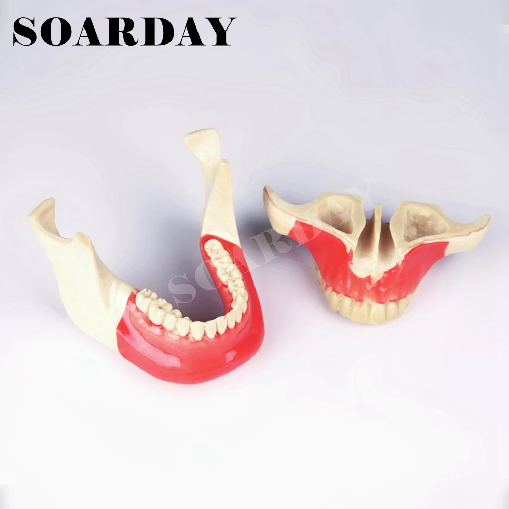 Implant Dental Practice model Foam plastic Imitation bone silicone skin Oral teaching practice model
Implant Dental Practice model Foam plastic Imitation bone silicone skin Oral teaching practice model