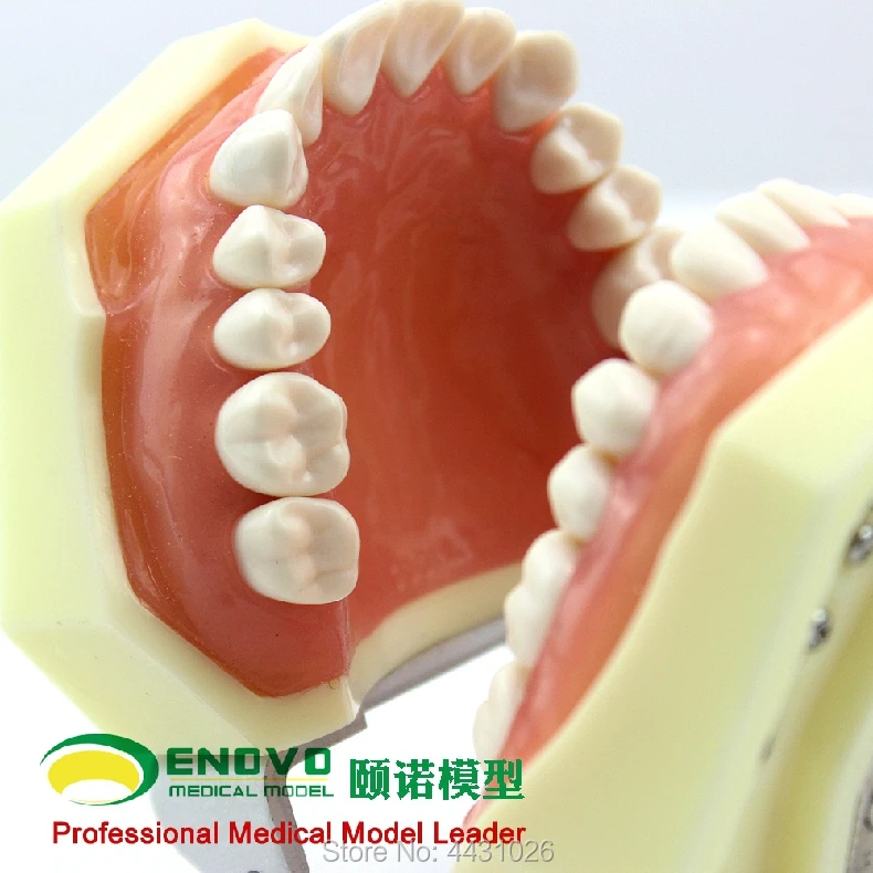 ENOVO The dental prosthesis of dental prosthesis was used to prepare the gingival prosthesis
ENOVO The dental prosthesis of dental prosthesis was used to prepare the gingival prosthesis