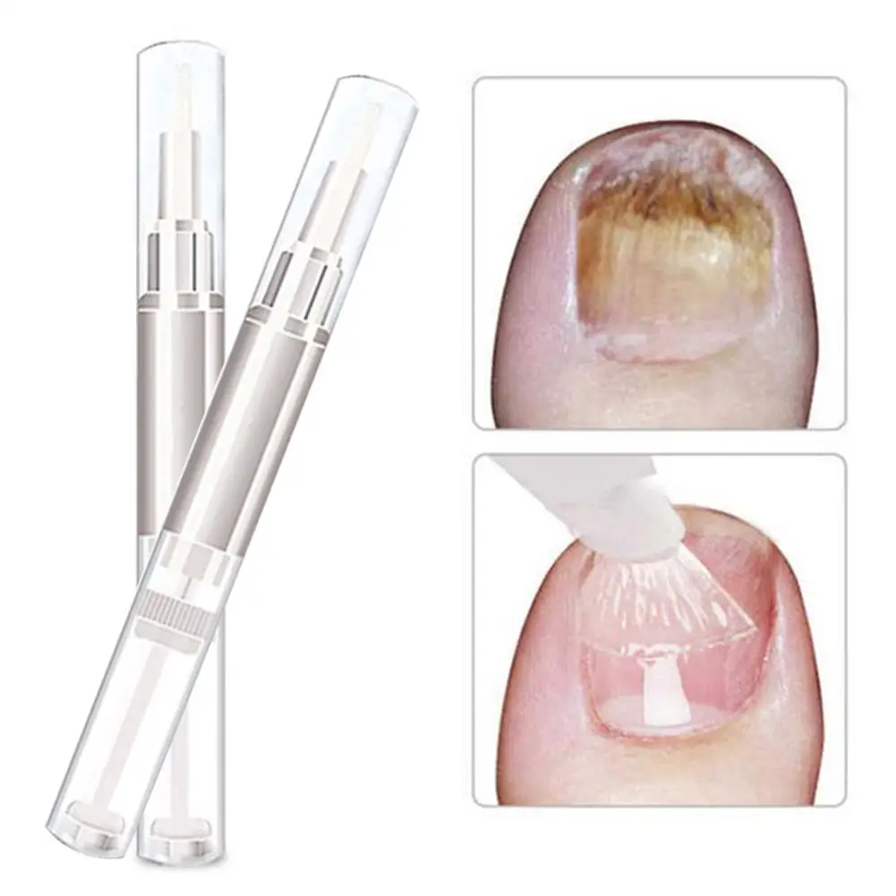 5Pcs Effective Herb Nail Care Solution Pen Fungus Treatment Anti Fungal Liquid 2019
5Pcs Effective Herb Nail Care Solution Pen Fungus Treatment Anti Fungal Liquid 2019