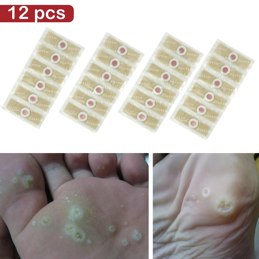 12PCS Medical Plaster Foot Corn Removal Warts Thorn patches Corn of foot Calluses Callosity Detox clavus Medical Patch
12PCS Medical Plaster Foot Corn Removal Warts Thorn patches Corn of foot Calluses Callosity Detox clavus Medical Patch
