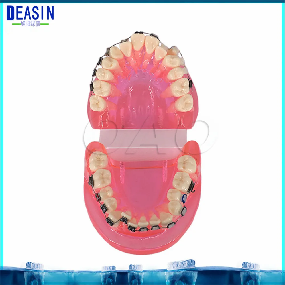 Teeth removable Dental implant Demonstration Bracket Simulation Caries Teeth Model Dentist Dental Study Teach Tooth Model
Teeth removable Dental implant Demonstration Bracket Simulation Caries Teeth Model Dentist Dental Study Teach Tooth Model