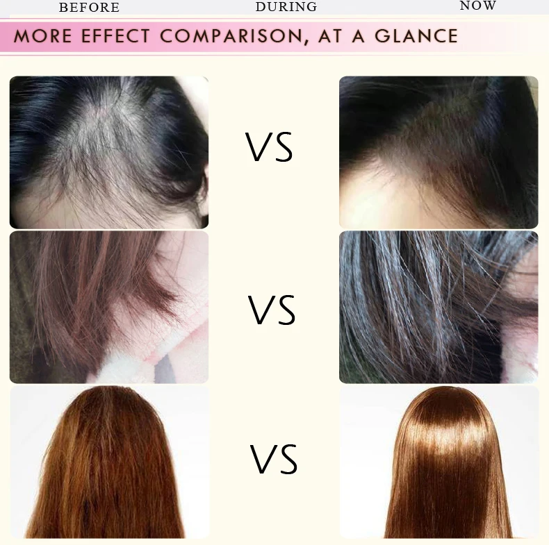 35ml Moroccan Hair Growth Essential Oil Prevent Hair Loss Product Easy to Carry Hair Care Nursing Both Male and Female Can Use
35ml Moroccan Hair Growth Essential Oil Prevent Hair Loss Product Easy to Carry Hair Care Nursing Both Male and Female Can Use