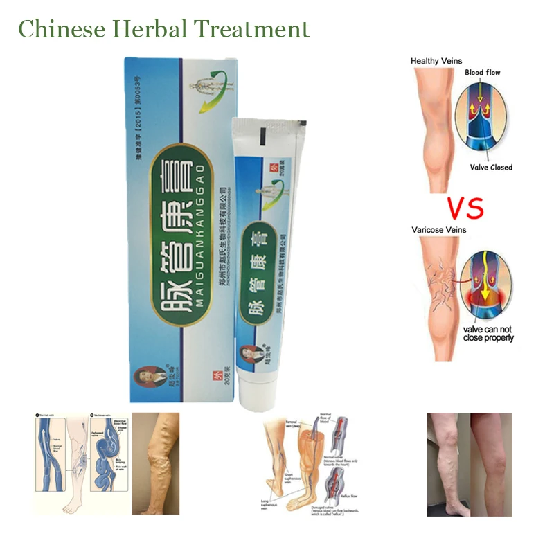 1pc Chinese natural herbal medicine for treating varicose vascular inflammation massage cream cure varicose vein ointment
1pc Chinese natural herbal medicine for treating varicose vascular inflammation massage cream cure varicose vein ointment