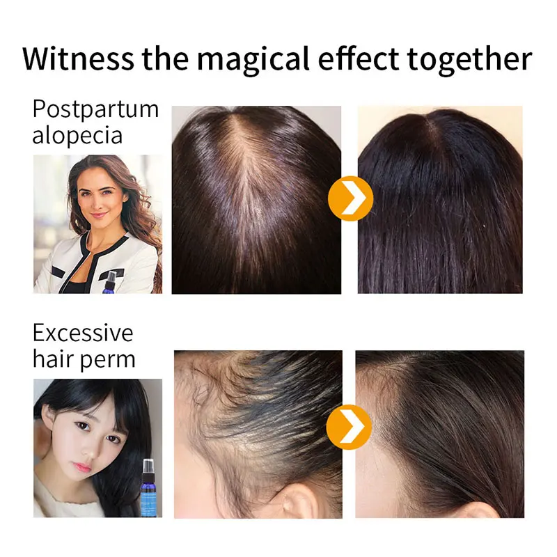 Professional Herb Hair Growth Liquid Hair Care Hair Growth Essential Oil Hair Serum Anti Loss Treatment Products
Professional Herb Hair Growth Liquid Hair Care Hair Growth Essential Oil Hair Serum Anti Loss Treatment Products