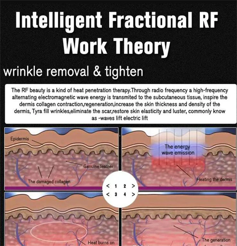 Fractional RF Machine Skin Tightening Wrinkle Removal Dot Matrix Lattic Facial Lifting Anti-aging Equipment
Fractional RF Machine Skin Tightening Wrinkle Removal Dot Matrix Lattic Facial Lifting Anti-aging Equipment
