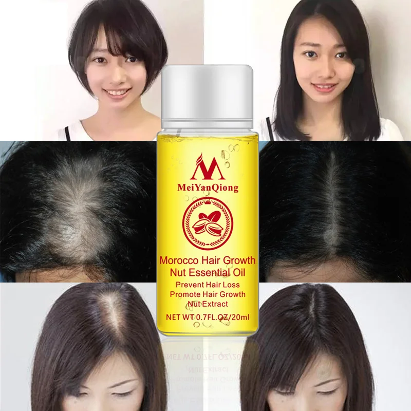 MeiYanQiong 20ML Fast Powerful Hair Growth Essence Hair Loss Products Essential Oil Liquid Treatment Preventing Hair Loss Hair
MeiYanQiong 20ML Fast Powerful Hair Growth Essence Hair Loss Products Essential Oil Liquid Treatment Preventing Hair Loss Hair